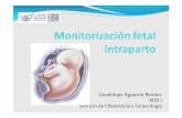 Guadalupe AguarónBenítez MIR 1 Servicio de Obstetricia y ... · MÉTODOS DE CONTROL DEL BIENESTAR FETAL INTRAPARTO Control de la expulsión de meconio: ... la existencia o no de