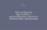 Miocardiopatía hipertrófica y miocardiopatía restrictiva · •Máx espesor septo 31 mm ¿Tienen el mismo pronóstico? Miocardiopatía hipertrófica. Miocardiopatía hipertrófica