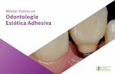Máster Online en Odontología Estética Adhesiva · Actualización en reducción dentaria para incrustaciones (inlay/onlay/overlay). 11.2.2. Criterios para la elección del material