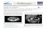 Solución caso radiológico 5 - scielo.conicyt.cl · Solucin caso radiolgico 5 101 Tabla 2 Diferencias clínicas entre actinomicosis pélvica y el cáncer de ovario Actinomicosis