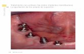 Tratamiento con prótesis fija sobre implantes mandibulares ... · tesis fija sobre implantes mandibulares. Se realizó un estudio radiológico con ortopantomografía y 3D Cone Beam