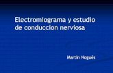 Electromiograma y estudio de conduccion nerviosa · 2019-05-30 · (Enf Agudas como el SGB) ... CIDP Síndrome de “ LEWIS SUMMER” Neuropatía motora multifocal Neuropatías anti