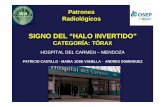 Patrones Radiológicos - XVI Congreso SORDIC 2017congreso.sordic.org.ar/uploads/2014/residentes/2014_105_Torax.pdf · Patrones Radiológicos . ETIOLOGIAS Fúngicas, bacterianas, P.