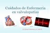 Cuidados de Enfermería en valvulopatías · enfermedades de las vÁlvulas del corazon ... cuidados de enfermeria. diagnostico ...