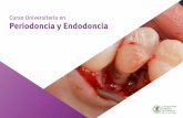 Curso Universitario en Periodoncia y Endodoncia · única, clave y decisiva para impulsar tu desarrollo profesional” 3.3.ratamiento no quirúrgico de la enfermedad periodontal.