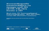 Ecocardiografía transesofágica en tiempo real 3D (ETE-TR ... · Estenosis mitral reumática n = 101 Concordancia Comparación: planimetría ETT-2D Área de la válvula mi tral.