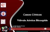 Casos Clínicos - FAC · estenosis e insuficiencia aórtica en los pacientes menores de 45 años. La VAB está altamente asociada con anormalidades congénitas de la aorta (Coartación,