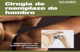 Cirugía de reemplazo de hombro (PDF) · La prótesis reemplaza las partes ásperas y 3 desgastadas de su hombro por partes plásticas y metálicas lisas. Cómo manejar sus preocupa