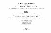CUADERNOS DE CITOPATOLOGÍA · 2016-10-06 · 30 Cuadernos de citopalogía-14 como “dedos de guante”, “semilunas”, “serpen-tina”, etc. Las células estromales, con mayor