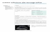 Paciente con insuficiencia renal, cuadro obstructivo ureteral … · 2013-06-05 · caso clínico de ecografía Paciente con insuficiencia renal, cuadro obstructivo ureteral unilateral.