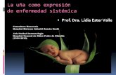 La uña como expresión de enfermedad sistémica · La uña como expresión de enfermedad sistémica. Prof. Dra. Lidia Ester Valle. El aparato ungueal es una estructura dinámica