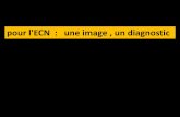 pour l'ECN : une image , un diagnostic - ONCLE PAULonclepaul.fr/wp-content/uploads/2011/07/une-image-un-diagnostic-di… · •-->Sigmoïdite perforée-bouchée. CAS 42 : Patiente