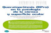 Queratoprótesis (KPro) en la patología de la córnea y ...€¦ · Queratoprótesis (KPro) en la patología de la córnea y superficie ocular Nº:36 María Fideliz de la Paz, MD1,
