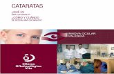 CATARATAS - Clinica Vila · del ojo, la técnica se denomina facoemulsificación, la forma standard en cirugía de la catarata, ya que precisa una incisión mínima y permite una