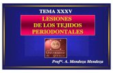 LESIONES DE LOS TEJIDOS PERIODONTALES · Profra. A. Mendoza Mendoza.A. Mendoza Mendoza TEMA XXXV LESIONES DE LOS TEJIDOS PERIODONTALES CONCUSION