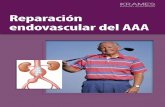 Reparación endovascular del AAA (PDF)€¦ · El siguiente paso: la reparación endovascular Enterarse de que tiene un AAA puede ser un shock. Pero hay tratamiento disponible. Su