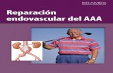 Reparación endovascular del AAA (PDF) · Enterarse de que tiene un AAA puede ser un shock. Pero hay tratamiento disponible. Su médico le recomienda la reparación endovascular.