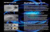 Autoﬂ uorescencia con láser azul · En caso de una degeneración macular asociada a la edad con atroﬁ a geográﬁ ca, las imágenes BluePeak muestran un contraste claramente