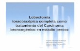 Lobectomía toracoscópica completa como tratamiento del ... · Nódulo pulmonar derecho en segmento lateral del LM, de 21x18 mm, SUVmax: 6.2 g/ml No se observan signos de recidiva
