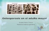 Osteoporosis en el adulto mayor · 2018-08-22 · Edad avanzada Baja ingestión de calcio Paciente caucásico Tabaquismo ... Disminución a partir de la tercera década lenta y progresiva
