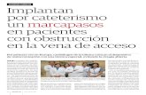 AVANCES CLÍNICOS Implantan por cateterismo un marcapasos ... · por cateterismo un marcapasos en pacientes con obstrucción en la vena de acceso Por primera vez en Europa, cardiólogos