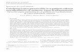 P DE CASO/C REPORT Calcifying Lupus panniculitis in a ... · 141 Vol. 18 Núm. 2 - 2011 CALCIFYING LUPUS PANNICULITIS IN A PATIENT WITHOUT MANIFESTATIONS OF SYSTEMIC LUPUS nodules