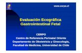 Evaluación Ecográfica Gastrointestinal FetalPara fetos con fístula traqueo esofágica aislada, sobrevida postoperatoria > 95% Atresia Duodenal Es el tipo más común de atresia