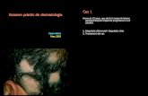 Cas 1 Examen pràctic de dermatologiadermatoweb2.udl.es/examenes_clinicos/ExamClin03m2.pdf · 8. Queratoacantoma 9. Carcinoma basocel.lular 10. Dermatitis atòpica 11. Dermatomiositis