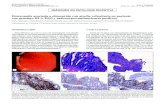 Enteropatía asociada a olmesartán con atrofia vellositaria ...scielo.isciii.es/pdf/diges/v108n11/es_imagenes1.pdf · 2016, Vol. 108, N.º 11 ENTEROPATÍA ASOCIADA A OLMESARTÁN