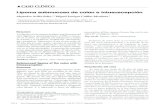 CASO CLÍNICO - Revista ACTA€¦ · Se recibió el producto de la sigmoidectomía que midió 52,0 x 5,5 cm. Al corte se identificó un pólipo submucoso de 4,5 x 4,2 x 3,2 cm (Figura