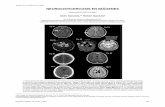 NEUROCISTICERCOSIS EN IMÁGENESns.bvs.hn/RMH/pdf/2010/pdf/Vol78-4-2010-6.pdf · Figura 4. C alcificación residual: Tomografía sin contraste mostrando una lesión hiperdensa parie-tal