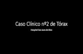 Caso Clínico Tórax...Caso Clínico nº2 de Tórax Hospital San Juan de Dios •Sexo masculino, 43 años •Antecedentes clínicos: •Tabaquismo detenido. •Motivo de consulta: