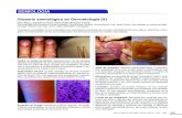 SEMIOLOGÍA - SOCHIDERM · 2015. 8. 11. · Signo del chal: lesiones eritematosas en región anterior y posterior de tórax, en zonas que cubre un chal; se ve en la dermatomiositis.
