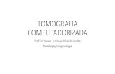 TOMOGRAFIA COMPUTADORIZADA - FisioSaleSecure Site fisiosale.com.br/.../Tomografia-Computadorizada.pdf• A tomografia computadorizada (TC), antes tomografia computadorizada axial (CAT),