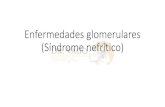 Enfermedades glomerulares (Síndrome nefrítico) · Síndrome nefrítico –hematuria glomerular aislada •Nefropatía por IgA •Depósitos mensagiales inmunes de IgA •Hematuria