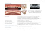 Protocolos de traumatología en dentición primaria –Actualización … · 2020. 8. 3. · Protocolos de tratamiento de las fracturas en dentición permanente – Actualización