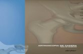 ARTROSCOPIA DE CADERA - Remeco · Soluciones para cadera Los avances recientes en el conocimiento y el tratamiento del de técnicas mínimamente invasivas para la restauración de