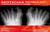 Mariano López Franco - SOMACOT...La enfermedad de Paget ósea (osteítis deformante) es un trastorno focal de la remodelación ósea que se caracteriza por un aumento de la reabsorción
