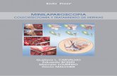 MINILAPAROSCOPIA - Karl Storz SE · 2020. 7. 30. · manipular instrumental laparoscópico para obtener una adecuada exposición quirúrgica. Aunque este tipo de técnica ha ido consolidándose