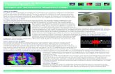 Imagen por Resonancia Magnetica (IRM)...IRM de una rodilla. Una nueva técnica de difusión en IRM proporciona un detalle sin precedente de las conexiones en el cerebro. Instituto