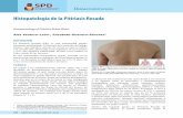 Histopatoology of Pitiriasis Rubra Pilaris