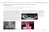 Obstrucción intestinal por cuerpo ... - Revista de Cirugía