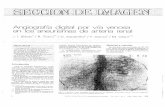 Angiografía digital por vía venosa en los aneurismas de ...
