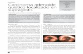 Caso Clínico Lois, Y García-Curdi, F Carcinoma adenoide ...