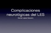 Complicaciones neurológicas del LES